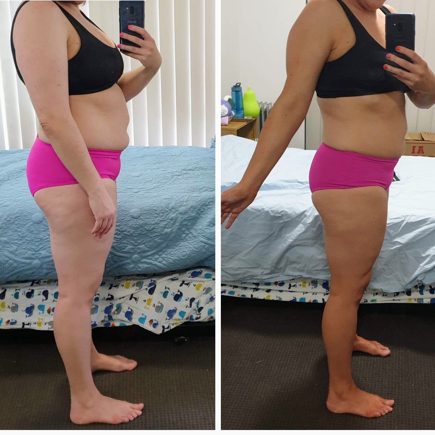Weight Loss Journey Before And After